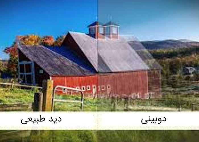 دو بینی - در ام اس