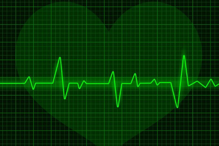 نوار قلب / ECG / EKG