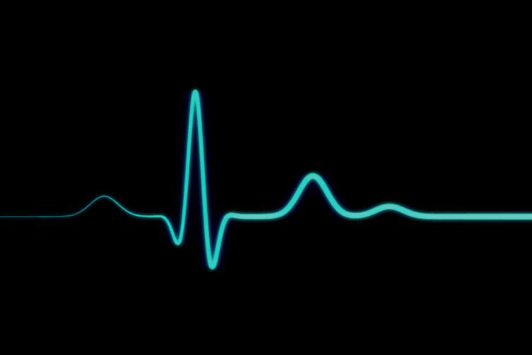 اپل واچ سری 4 و توانایی ثبت ECG؛ آیا باید ادعاهای اپل را باور کنیم؟