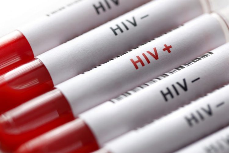 HIV و ایدز، علایم، درمان و پیشگیری