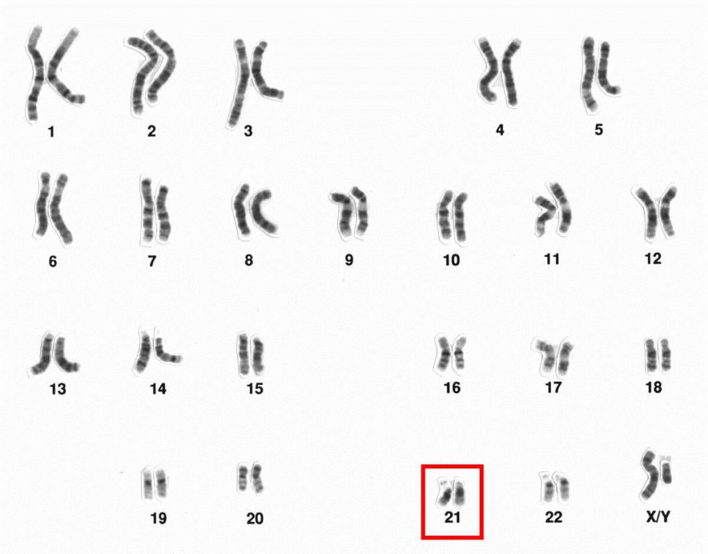 کروموزوم 21 / Chromosome