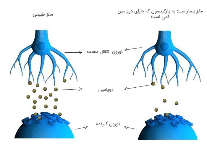 دوپامین در پارکینسون