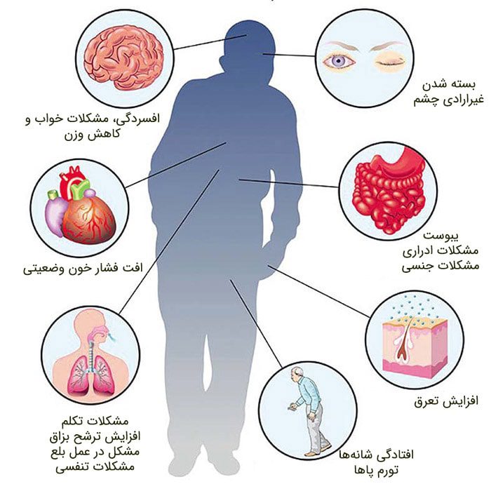 علایم پارکینسون